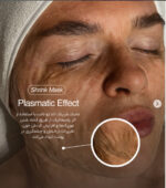 شرینک ماسک اکلادوتانت